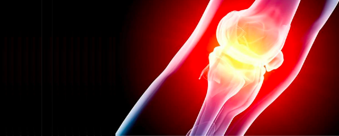 Arthritis Foundation publica las primeras pautas para pacientes que usan CBD para aliviar el dolor